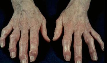 u=499810592,1397217943&fm=21&gp=0 u=499810592,1397217943&fm=21&gp=0